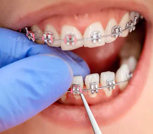 Cochin Orthodontics, Kochi