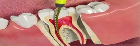 Complex dental restorations at Cochin