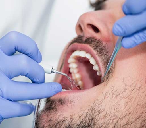 Cochin Conservative Dentistry, Kochi