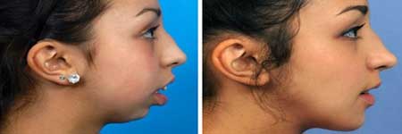 Maxillofacial Surgery at Kochi, Cochin, Kerala